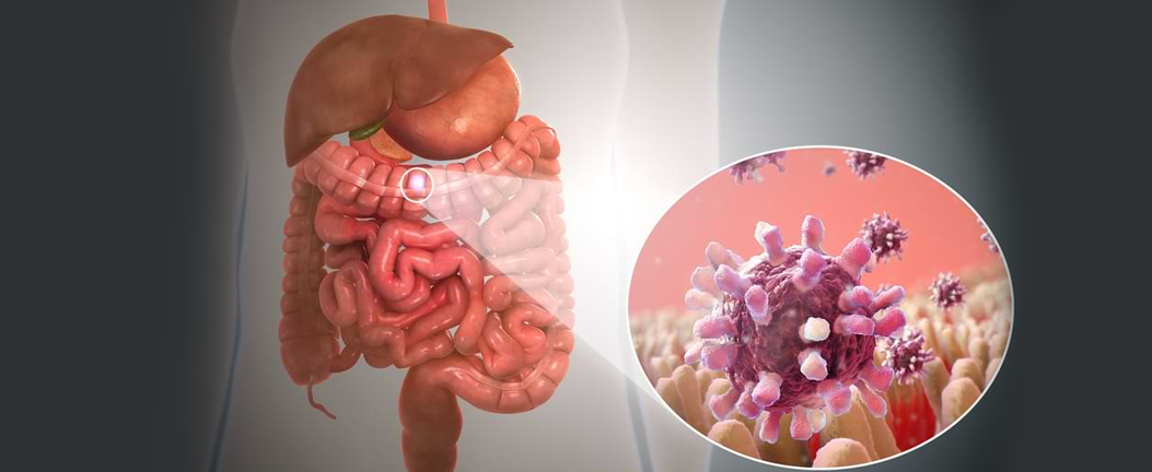 GI Malignancies / HCC